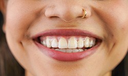 closeup of a smiling young woman wearing Invisalign aligners
