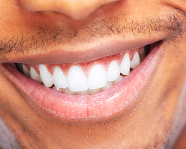 Closeup of a man smiling